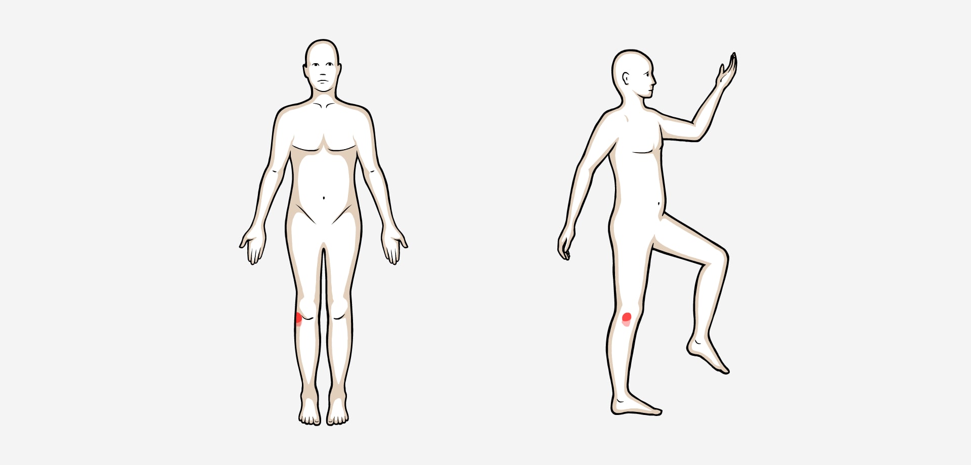 Dolor lateral rodilla